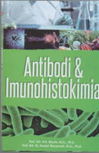 Image of Antibodi & imunohistokimia